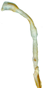 Rhagium (Megarhagium) fasciculatum: endophallus